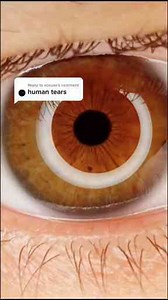 Exploring Human Tears Under a Microscope