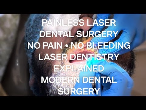 Scared of Dental Surgery? Discover Laser Oral Treatment, painless,no bleeding.