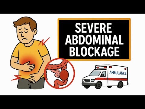 NREMT Guide to Bowel Obstruction Symptoms