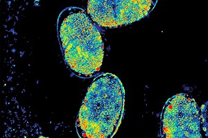 Shwetadwip Chowdhury Receives Frontiers of Imaging Grant to Develop Computational Microscopy for Deep Tissue Imaging