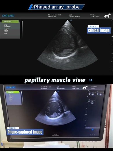 Dawei Veterinary Ultrasound Device