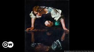 Narcissistic personality disorder