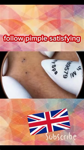 Big pimple blackhead removal #popping #satisfying #explore #extractions #blackhead #pimple