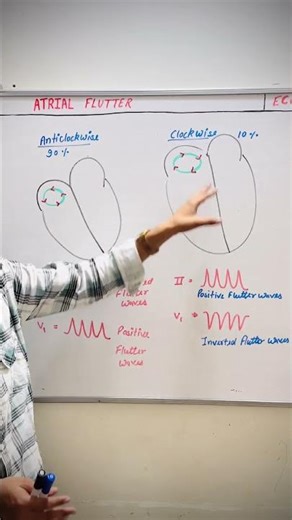 Atrial Flutter: Clockwise vs Anticlockwise Pattern Explained⚡ #cardiology #biology #medical #medico