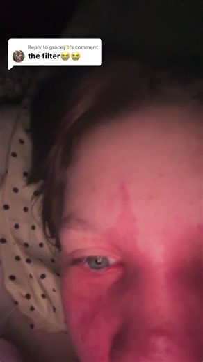 Debunking Filter Accusations: My Natural Look & Real Prom Dress Diary