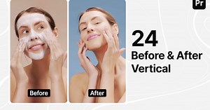 Before and After - Instagram Stories