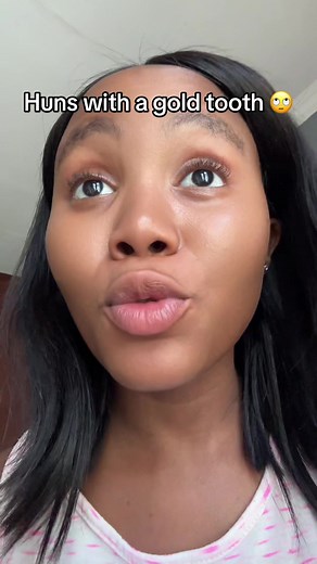 Exploring the Allure of Gold Teeth in South Africa