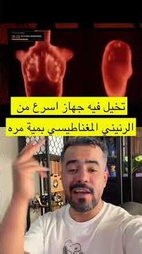 جهاز سكان أسرع 100 مرة من الرنين المغناطيسي! 🧠 #الذكاء_الاصطناعي #midjourney #ai #ذكاء_اصطناعي