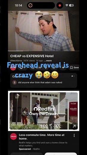 Crazy Beck Bros forehead reveal 😭😆🤣