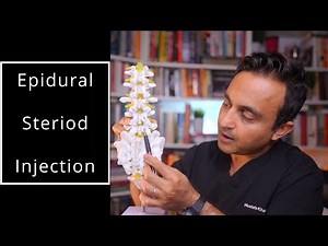 Epidural steroid injection