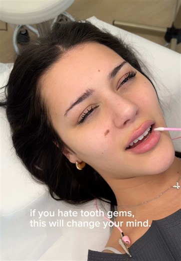 Tooth Gems and Whitening Combo: Shine Bright!