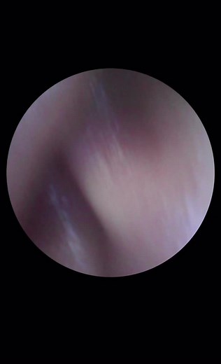 Understanding the Human Ear Canal Anatomy