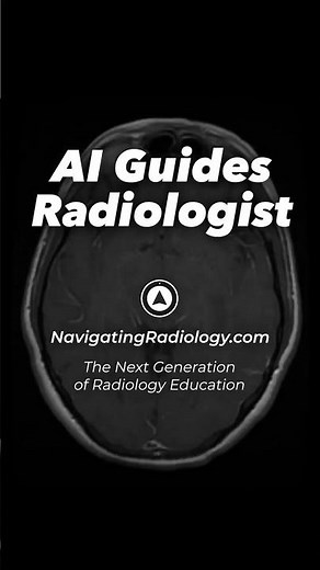 AI Attending: The Next Generation of Radiology Education