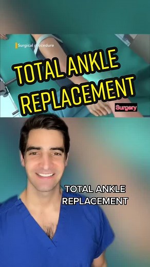 Total Ankle Replacement Surgery Video