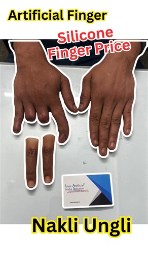 Ideal Artificial limbs Solution on Reels