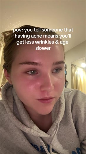 Understanding Acne and Its Impact on Aging