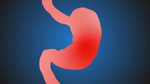 Stomach pain, animation. Spasm in the stomach. cartoon animation of the stomach