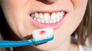 From ulcers to gums - what your mouth says about your health & when to worry
