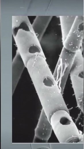 Microscopic Predator: The Vampire Amoeba