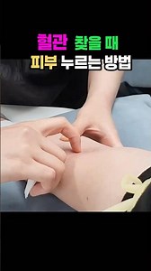 혈관 찾는 방법, 피부 누르기 정맥주사