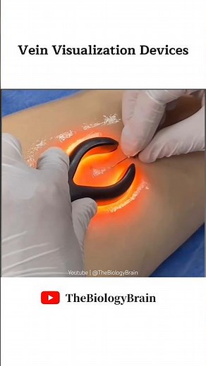 Vein Visualization Device That Helps to Find Vein. #health #shorts #youtubeshorts #phlebotomy