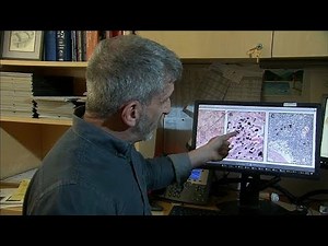 New organ could help understand spread of cancer