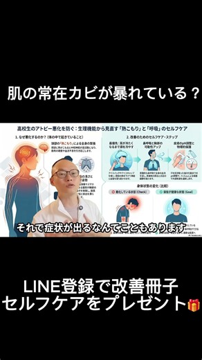The Truth About the Fungus That Makes You Itchy When You Sweat