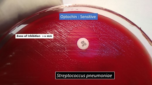 Optochin Susceptibility test :Principle, procedure, result and interpretation