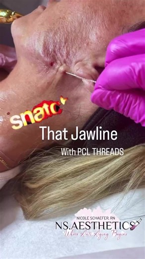 PCL Threads: Lift and Tighten Your Jaw and Neck