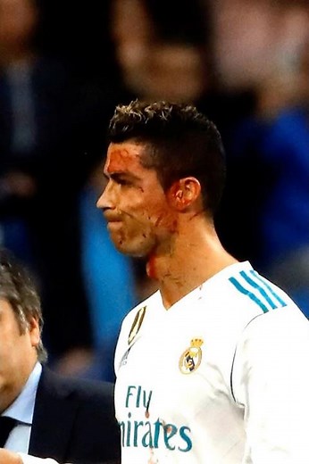 C.Ronaldo covered in blood 🩸🩸🩸 #cristianoronaldo