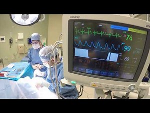 Anesthetics and Oculocardiac Reflex (OCR) - Supplementary Video [ID 300860]
