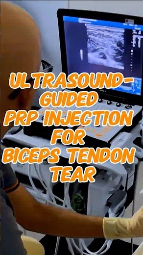 Watch a precision ultrasound-guided PRP injection to treat a proximal biceps tendon tear