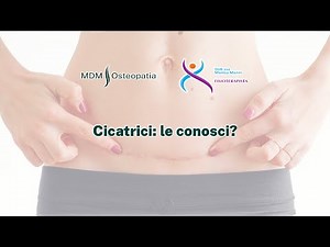 Le cicatrici: le conosci?