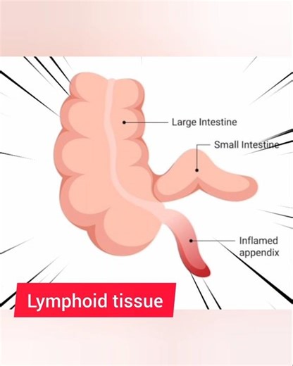 Why do we have an appendix if it doesn't have use in our body #shorts #trending #doyouknow