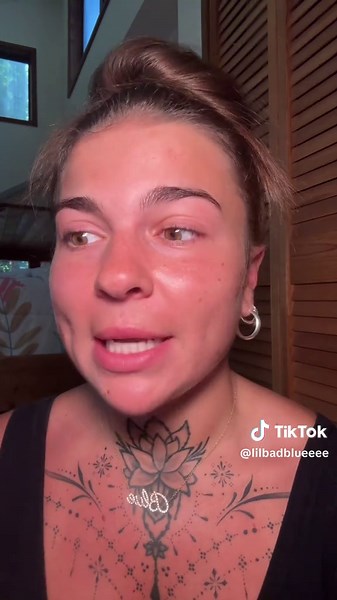 Catrice Lip Balm Review: What You Need to Know