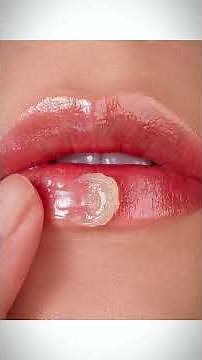 Dark Lips Fix Easily With These Steps 😱