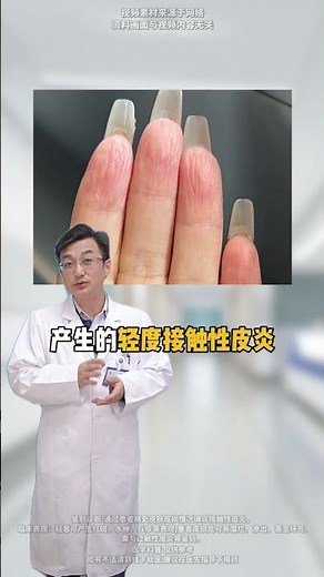 这两种常见的手部问题，可不是小问题，千万不要忽视！ #接触性皮炎 #角化型湿疹 #手部护理 #抖出健康知识宝藏 #新年囤点专业货