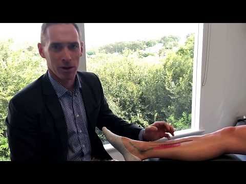 Shin Splints Explained (Medial Tibial Stress Syndrome)