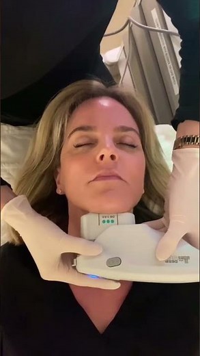 Ultherapy in Action
