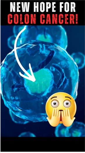 Justin | Natural Cures | Longevity | Holistic Health on Instagram: "They found something that killed 95% of colon cancer cells in 48 hours, and it’s completely natural. When I first read that, it was hard to believe. A 2016 Canadian study looked at human colon cancer cells and found that this natural extract triggered programmed cell death, in 95% of the cells, without harming healthy ones. Then they gave it orally to mice. Tumor growth dropped by over 90%. No side effects. No toxicity. That's c