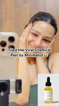 🔥 I Tried Minimalist’s Chemical Peel on Sensitive Skin | Better Than The Ordinary? #minimalist