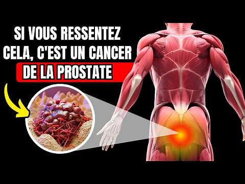 Cancer de la prostate : 10 signes et symptômes précoces à ne pas ignorer !