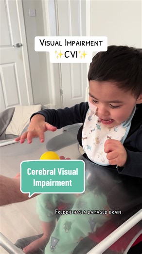 Understanding Cerebral Visual Impairment in Children