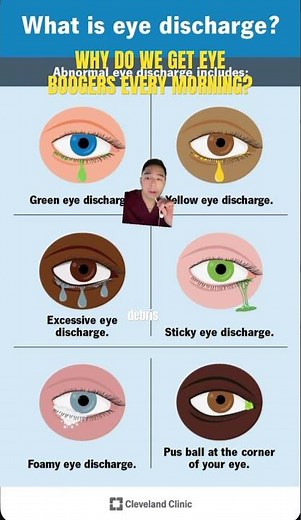 Ever wonder what eye boogers really are? #shorts #viral #eyehealth