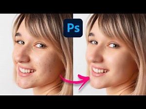 How to remove blemishes to skin smooth in Photoshop using free download filter