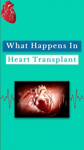 How a Heart Transplant Really Works | Explained by Dr. Amit Chandan