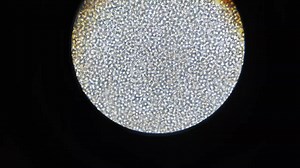 ☘️ What is pus cell? Pus cells are white blood cells that the body releasee to fight infection in the urinary tract, bladder, ureters, kidney or surrounding areas. ☘️ Pyuria is a condition in which you have high level of pus cells in your urine. ☘️ Normal range is : 0-5 pus cell per high power field (HPF). Any thing above these range is usually considered abnormal and could indicate an infection or inflammation in the urinary tract infection, slightly variation may occur due to dehydration, mino