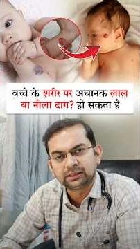 Hemangioma क्या है? बच्चों में लाल या नीले दाग की जानकारी #drhareshpediatrician