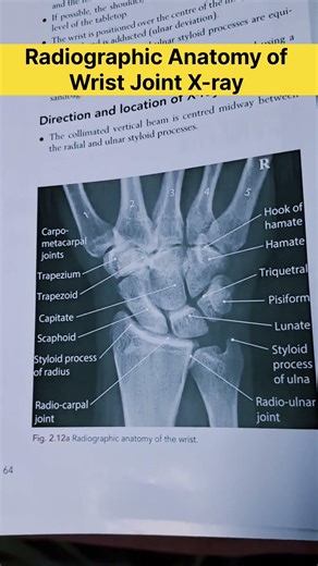 Wrist Joint X-ray Anatomy #radiographerusn