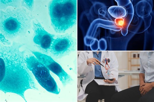 Prostate cancer risk increases by 45% among men who share one troubling behavior